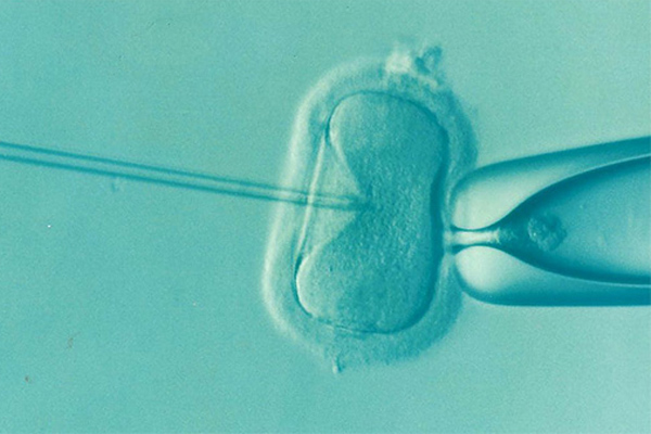 卵泡浆内单精子注射