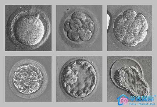 胚胎.jpg